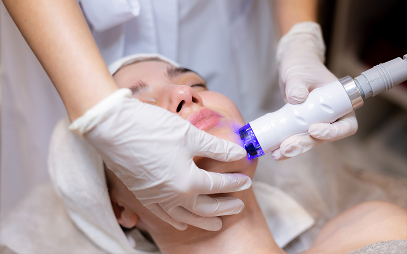 Patient receiving targeted laser facial treatment for pigmentation reduction.
